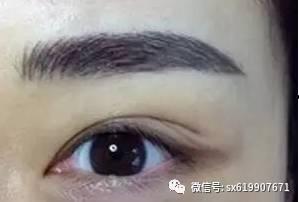 绿蜜瓜黑眉毛可以吃吗,揭秘能否安全食用之谜